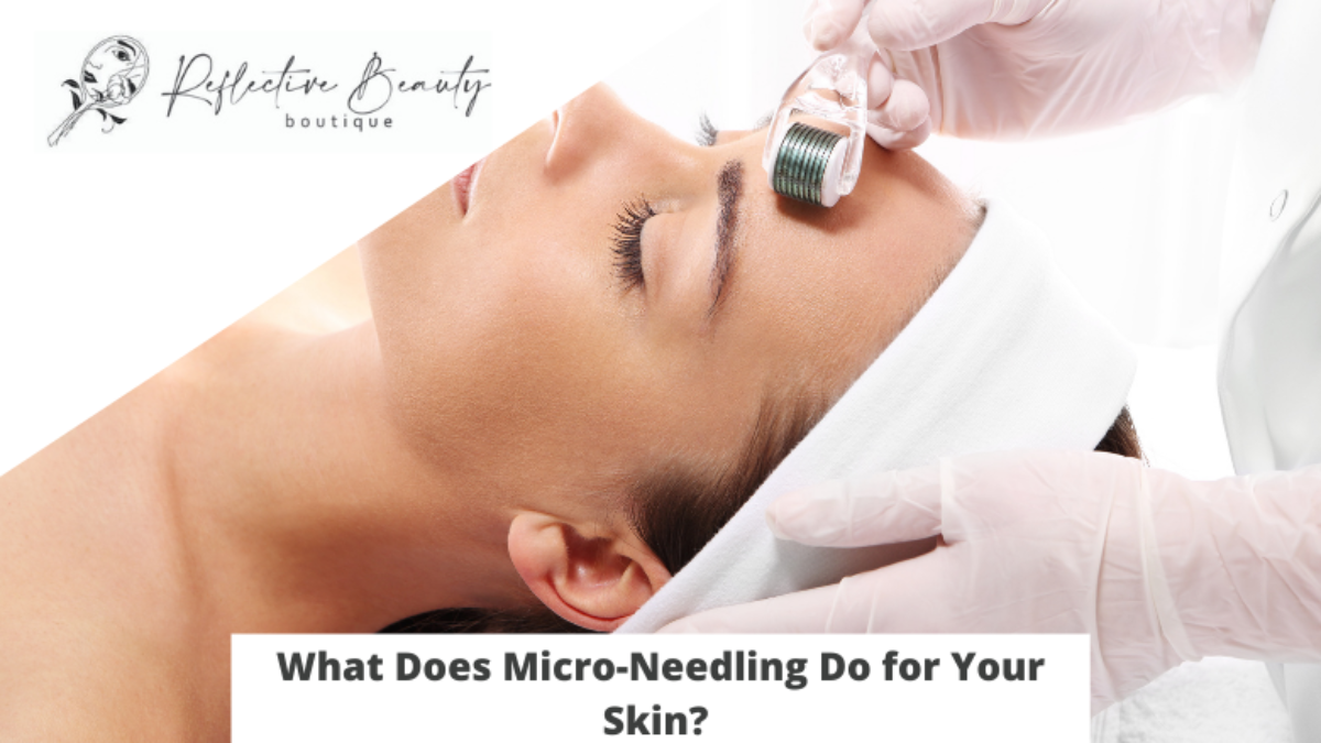 What Does Micro-Needling Do for Your Skin