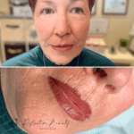 Permanent Lip Tattoo Calgary