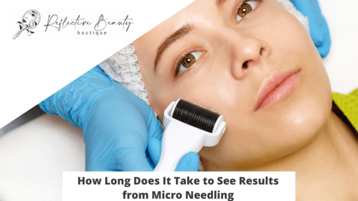 How Long Does It Take to See Results from Micro Needling