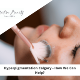Hyperpigmentation Calgary - How We