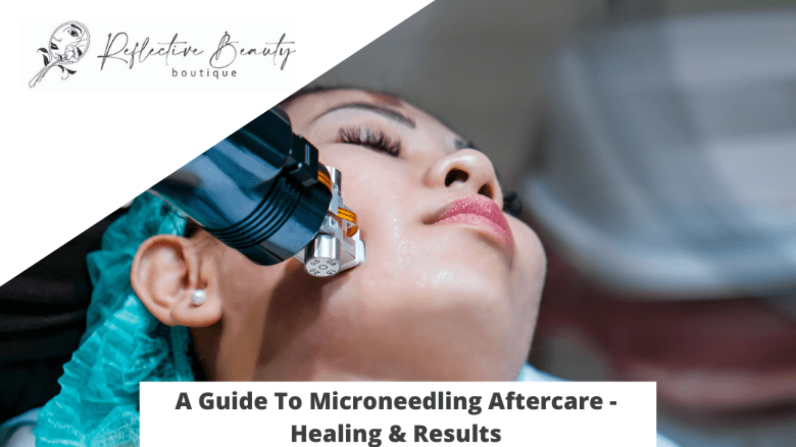 A Guide To Microneedling Aftercare - Healing & Results