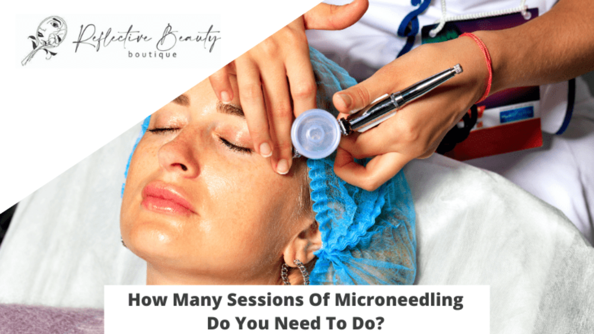 How Many Sessions Of Microneedling Do You Need To Do