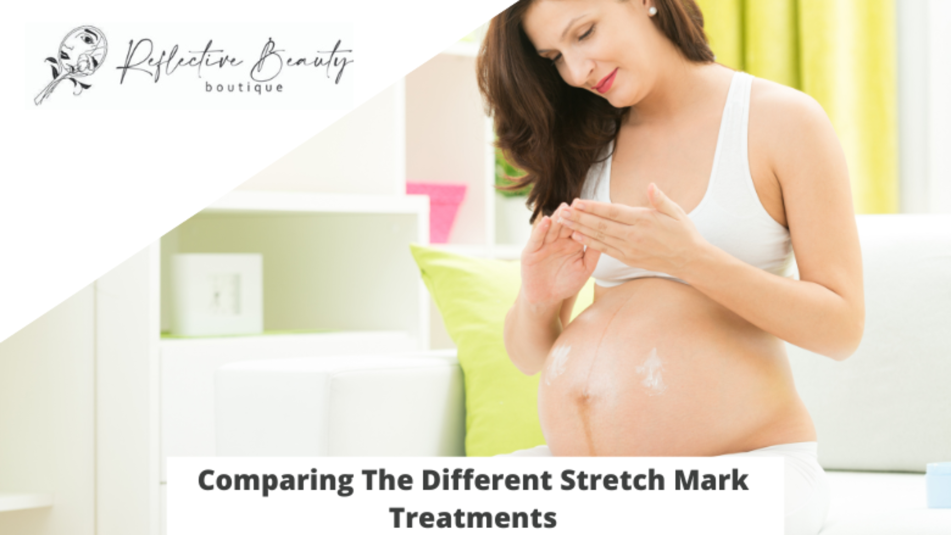 Comparing The Different Stretch Mark Treatments